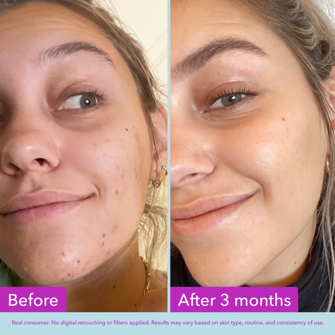 niacinamide-brightening-toner-l3 zb_p.jpg