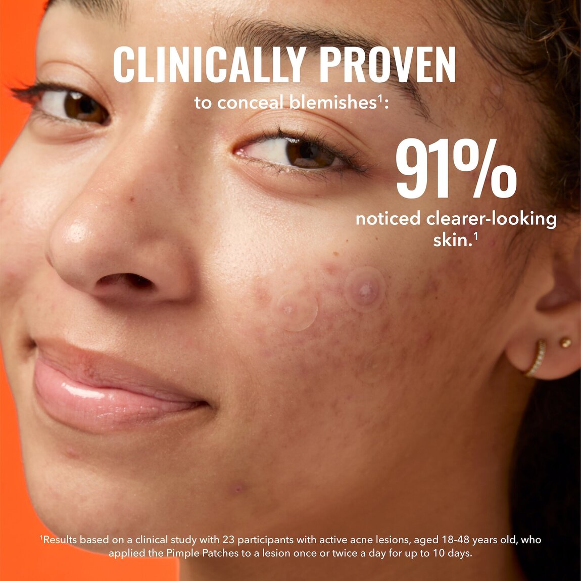 pimple-patches-p7 zb_p.jpg