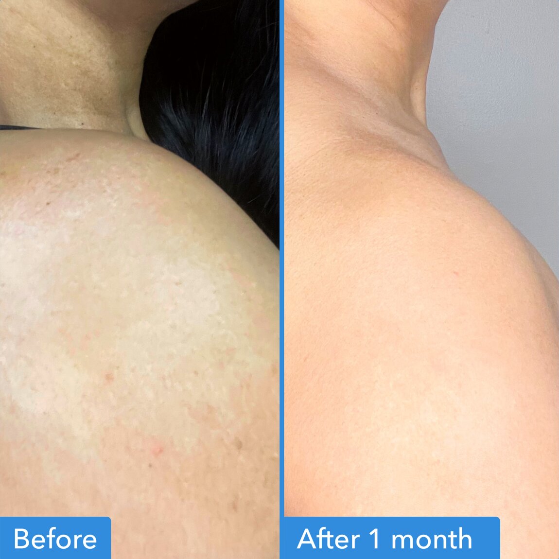 discoloration-correcting-body-treatment-v5 zb_p.jpg